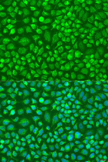 Anti-DNAL1 Polyclonal Antibody (CAB8267)