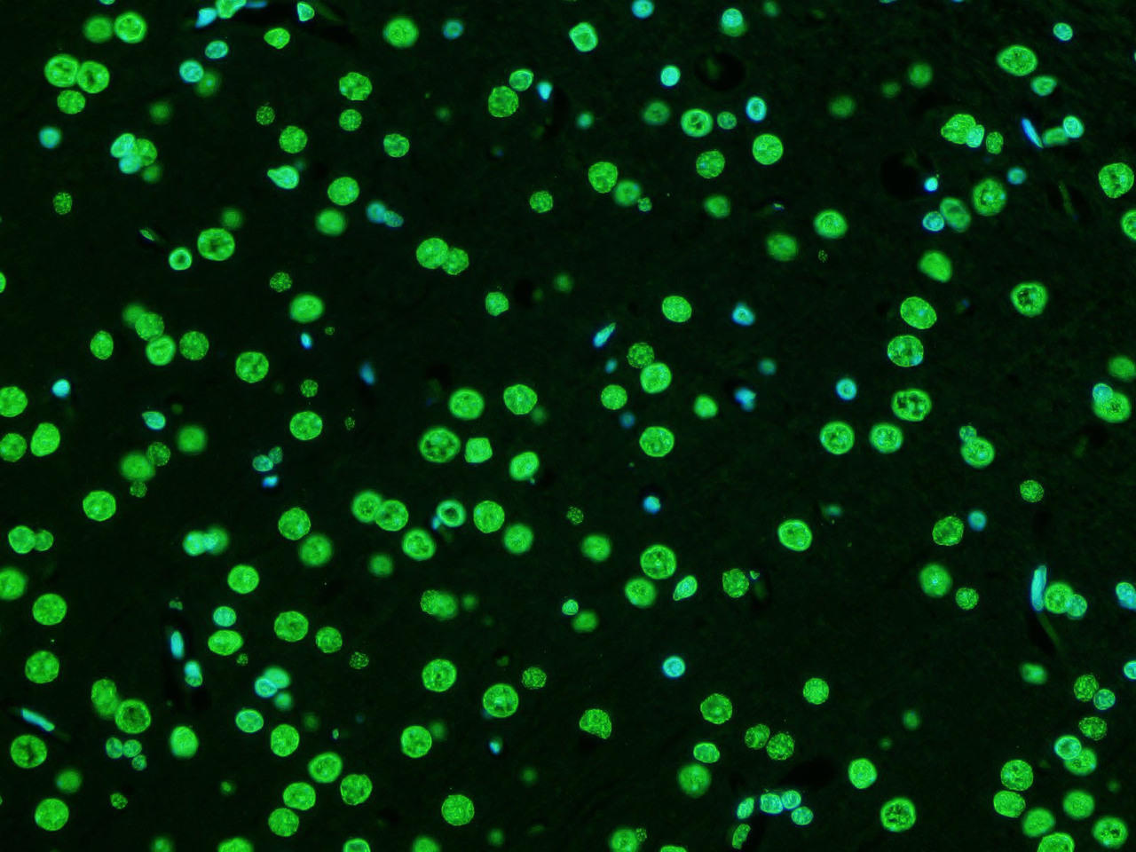 Paraffin embedded rat brain was treated with DNAse I to fragment the DNA. DNA strand breaks showed intense fluorescent staining in DNAse I treated sample (green). The cells were counterstained with DAPI (blue).