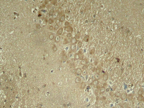 Anti-Phospho-MAPT-S262 Antibody (CABP0397)