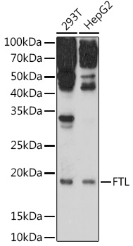 Anti-FTL Antibody (CAB1768)