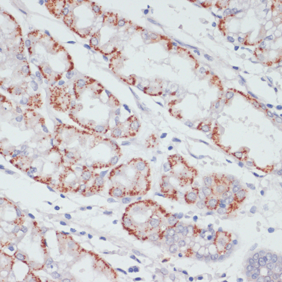 Anti-ACSL3 Antibody (CAB11679)