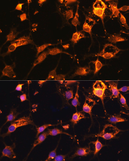 Anti-DRP1 Antibody [KO Validated] (CAB17069)