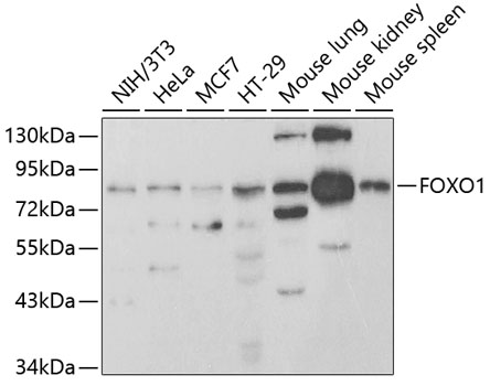 Anti-FOXO1 Antibody (CAB2934)