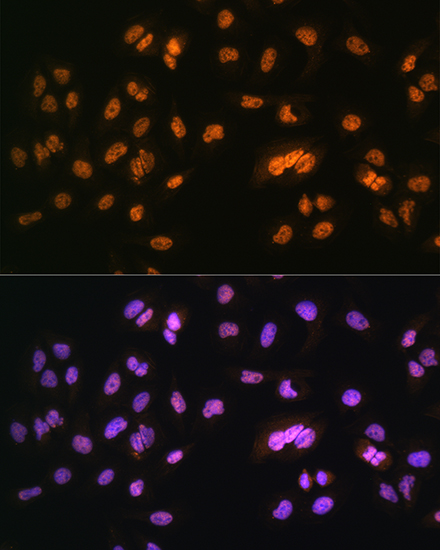 Anti-NR2F2 Antibody (CAB10251)