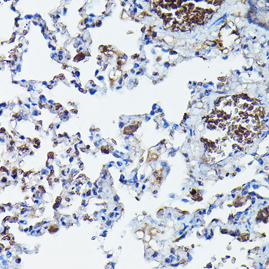 Anti-APOBEC3G Antibody (CAB13598)