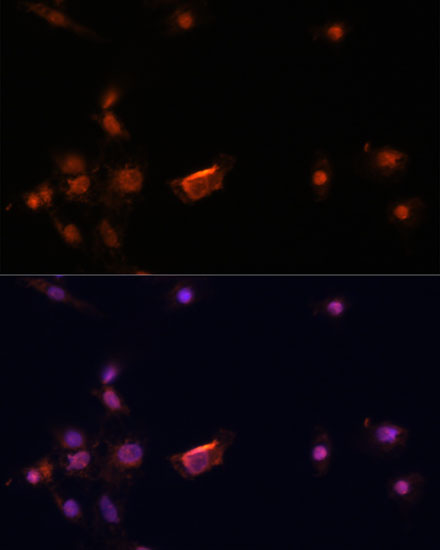 Anti-BRCA2 Antibody (CAB2435)