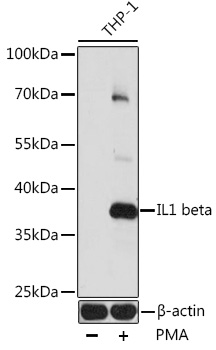 Anti-IL-1 beta Antibody (CAB11370)