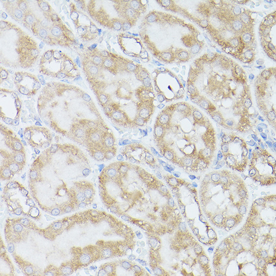 Anti-RPS18 Antibody (CAB11687)