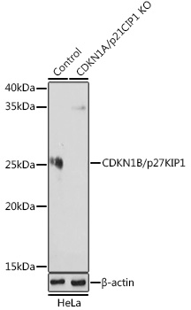 Anti-CDKN1B/p27KIP1 Antibody [KO Validated] (CAB19095)