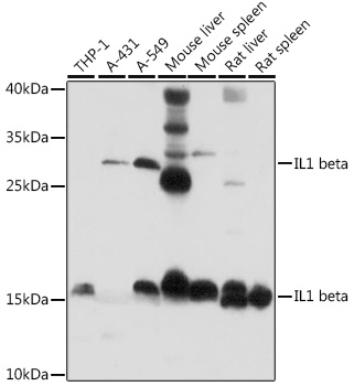 Anti-IL-1 beta Antibody (CAB11369)