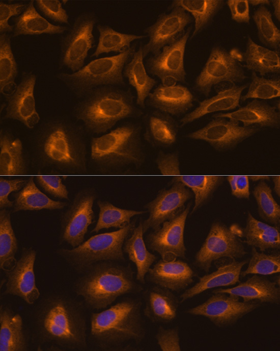 Anti-KARS Antibody (CAB13772)