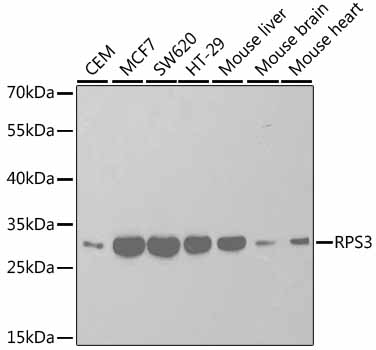 Anti-RPS3 Antibody (CAB2533)