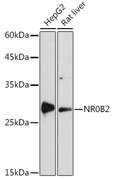 Anti-NR0B2 Antibody (CAB1836)