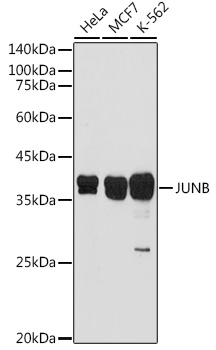 Anti-JUNB Antibody (CAB14566)