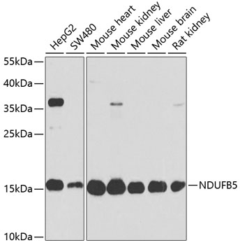 Anti-NDUFB5 Antibody (CAB14752)