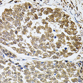 Anti-c-Fos Antibody (CAB2444)