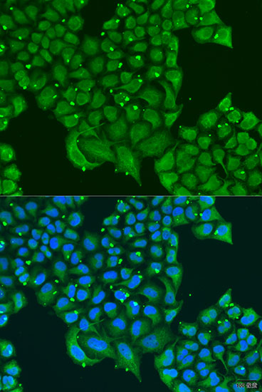 Anti-ATPIF1 Antibody (CAB5099)