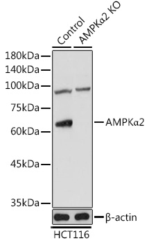 Anti-AMPKAlpha2 Antibody [KO Validated] (CAB7339)