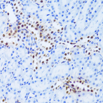 Anti-ANP32A Antibody (CAB5768)