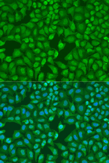 Anti-MonoMethyl-UHRF1-K385 Antibody (CAB16008)