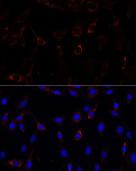 Anti-RNF112 Antibody (CAB15333)