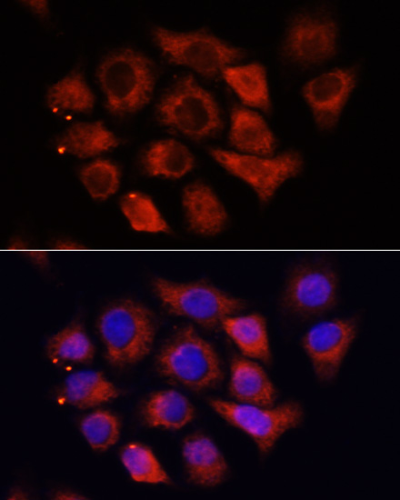 Anti-HMGA1 Antibody (CAB1635)