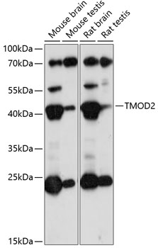 Anti-TMOD2 Antibody (CAB14881)