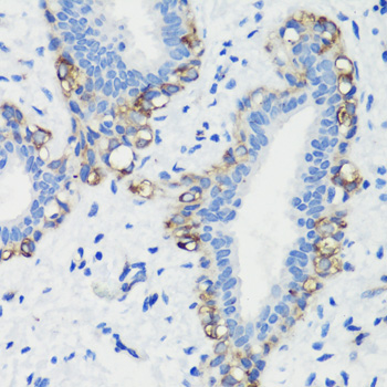 Anti-FLNA Antibody (CAB7896)