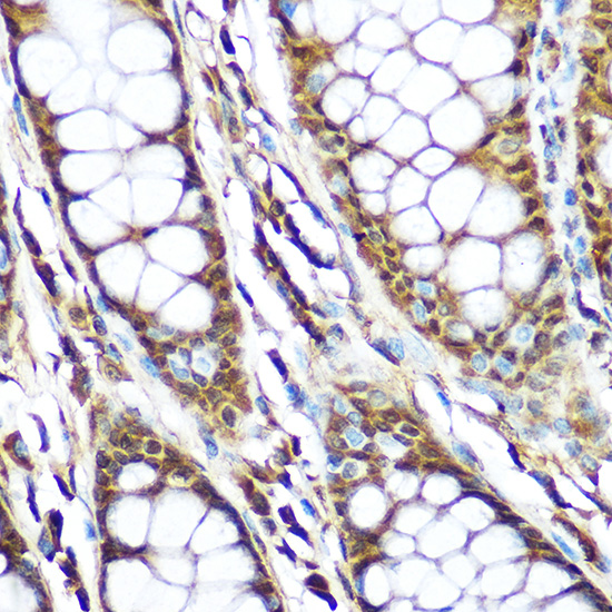 Anti-LIG3 Antibody (CAB13507)