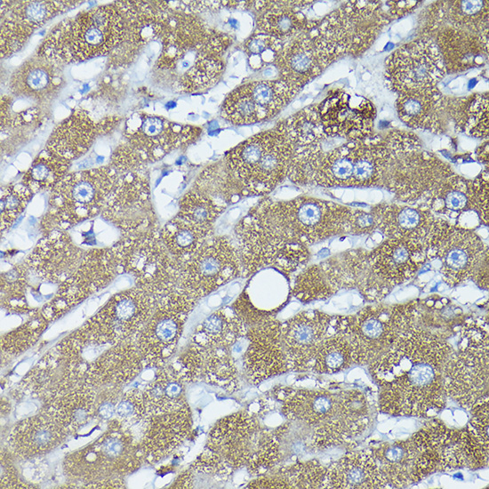 Anti-FXN / Frataxin Antibody (CAB1745)