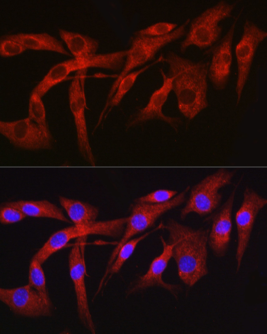 Anti-FURIN Antibody (CAB7445)