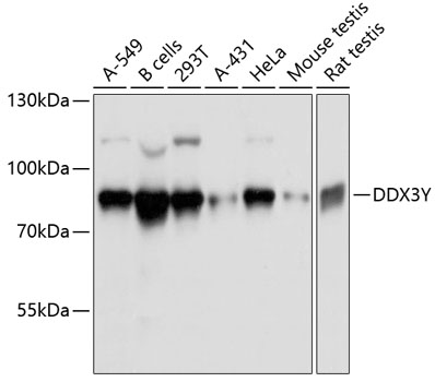 Anti-DDX3Y Antibody (CAB11704)