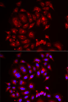 Anti-SLC26A2 Antibody (CAB6369)