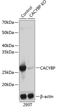 Anti-CACYBP Antibody [KO Validated] (CAB20004)