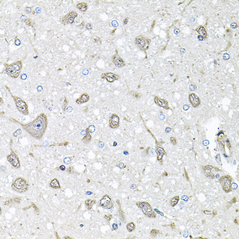 Anti-FGF1 Antibody (CAB0685)