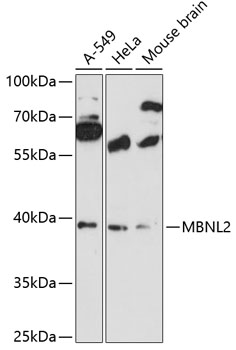 Anti-MBNL2 Antibody (CAB12838)