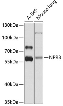 Anti-NPR3 Polyclonal Antibody (CAB8138)