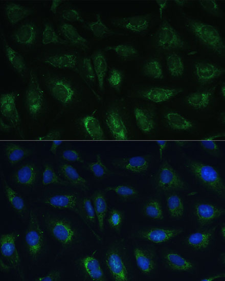 Anti-RAPGEF1 Antibody (CAB16050)