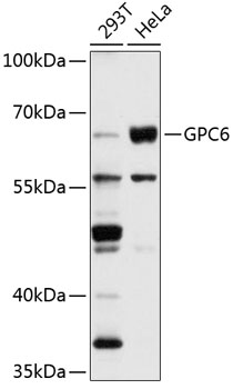 Anti-GPC6 Antibody (CAB2741)