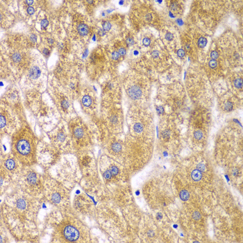 Anti-RPN1 Antibody (CAB6726)