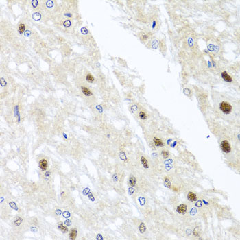 Anti-YTHDF3 Polyclonal Antibody (CAB8395)