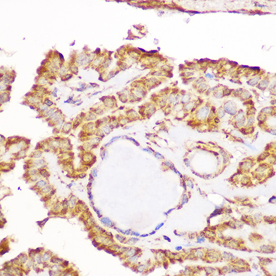 Anti-GFRA1 Antibody (CAB5373)