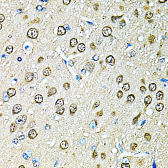 Anti-PSMB1 Antibody (CAB1043)