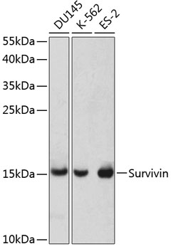 Anti-Survivin Antibody (CAB1551)