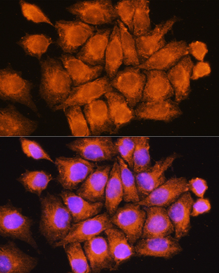 Anti-CFAP53 Antibody (CAB16607)