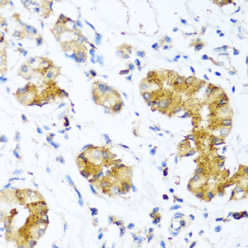 Anti-WFDC2 Antibody (CAB6788)