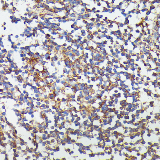 Anti-CSF3 Antibody (CAB6178)