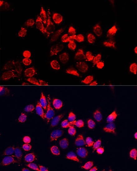 Anti-NFE2L1 Antibody (CAB14753)