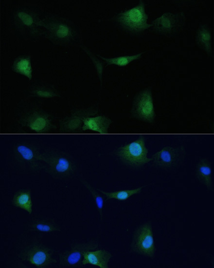 Anti-VCP Antibody (CAB13368)