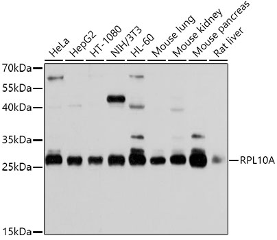 Anti-RPL10A Antibody (CAB5925)